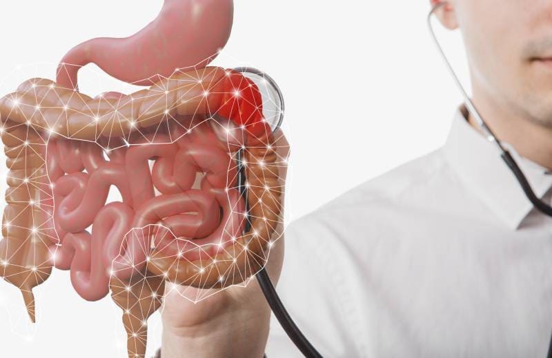 Detección y vigilancia del cáncer colorrectal ofrecida por él Dr. Luis Alberto Espino Urbina