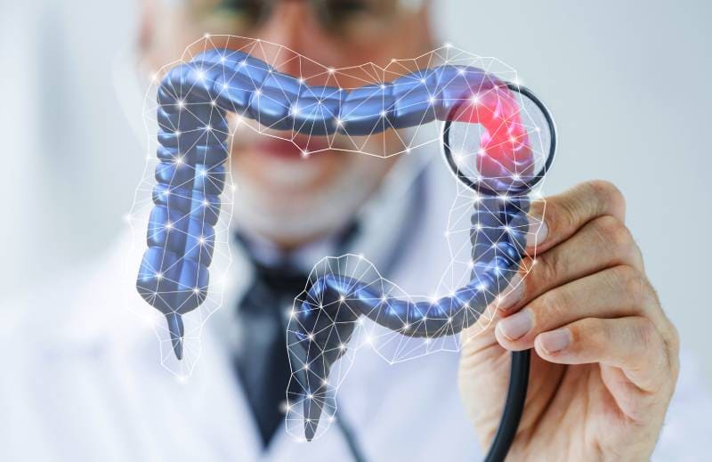 Tratamiento a  Pólipos del colon y recto  ofrecido por él Dr. Luis Alberto Espino Urbina - Especialista en Cirugía general y gastrointestinal